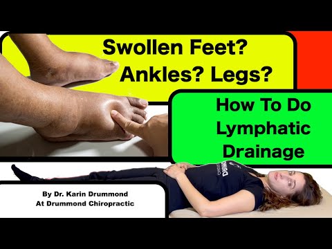 Self Lymphatic Drainage Massage For Swollen Feet, Ankles & Legs